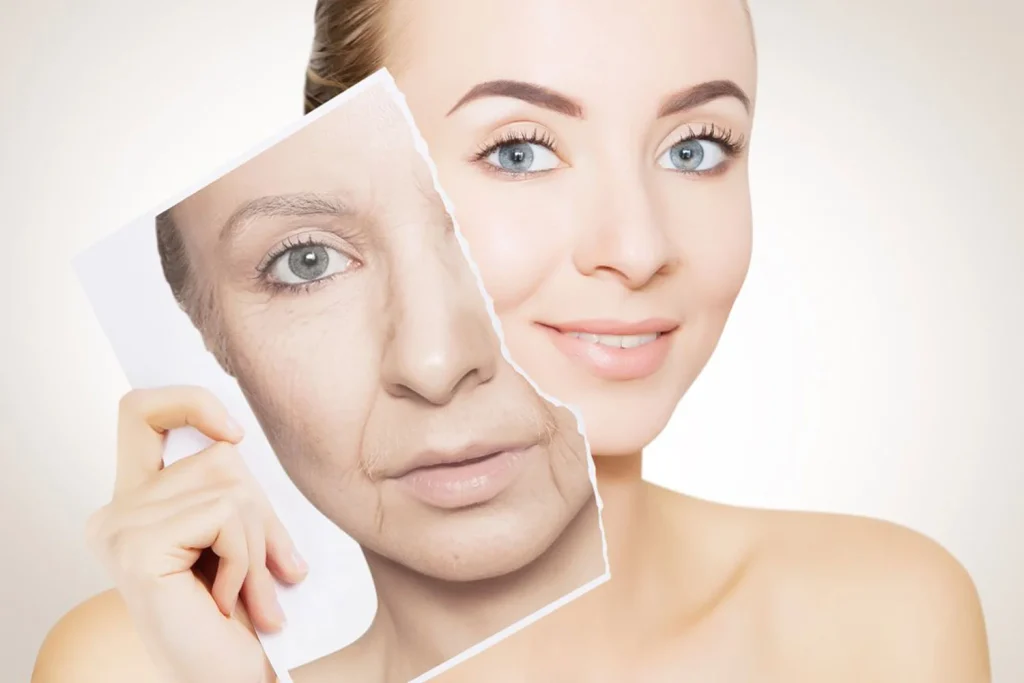 Anti aging tedavisi